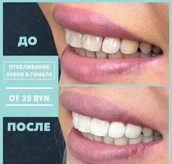 Зубок отзывы