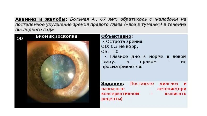 Глубина передней камеры биомикроскопия. Зрачковая реакция на свет дна. Острота зрения правый глаз левый глаз