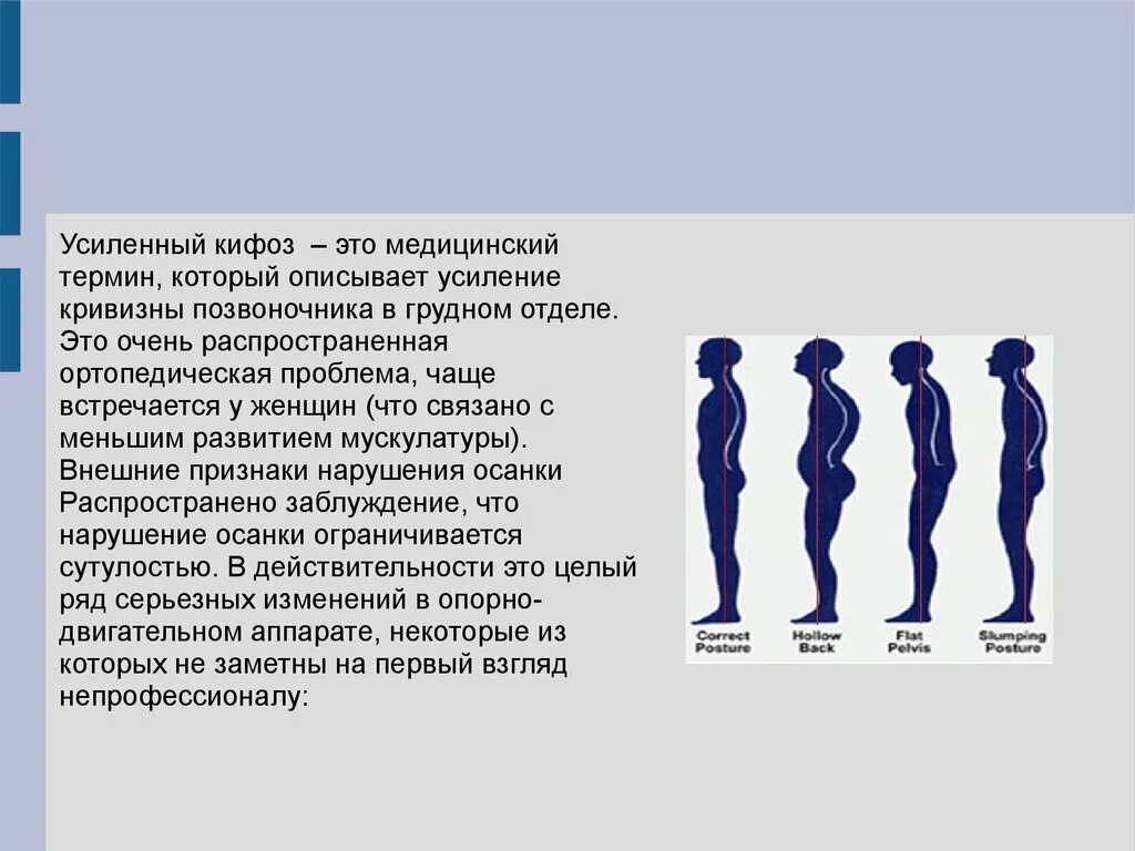 Усиление грудного кифоза. Усиленный кифоз. Старческий кифоз развивается в связи с. Усиленный грудной кифоз.