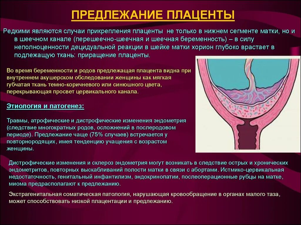 Полное предлежание форум. Наиболее вероятно предлежание плаценты. Клинический симптом предлежания плаценты. Предлежание плаценты симптомы. Диагностические критерии предлежание плаценты.