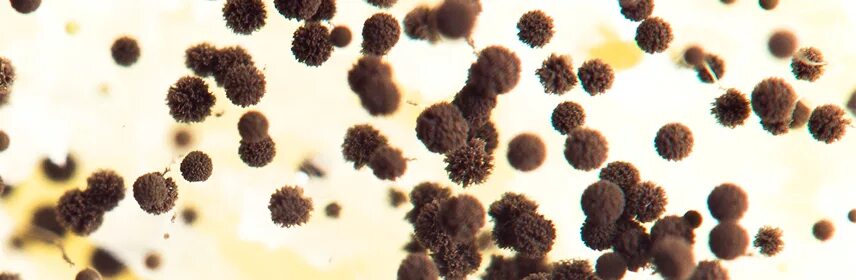 Грибы под микроскопом. Споры плесени. Черная плесень под микроскопом. Споры плесени в воздухе. Влияние плесени на организм человека.