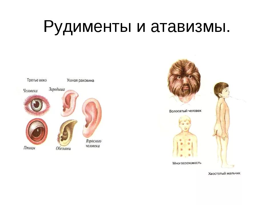 К атавизмам относятся. Атавизмы и рудименты различия. Рудименты человека атавизмы человека. Рудименты человека многососковость.