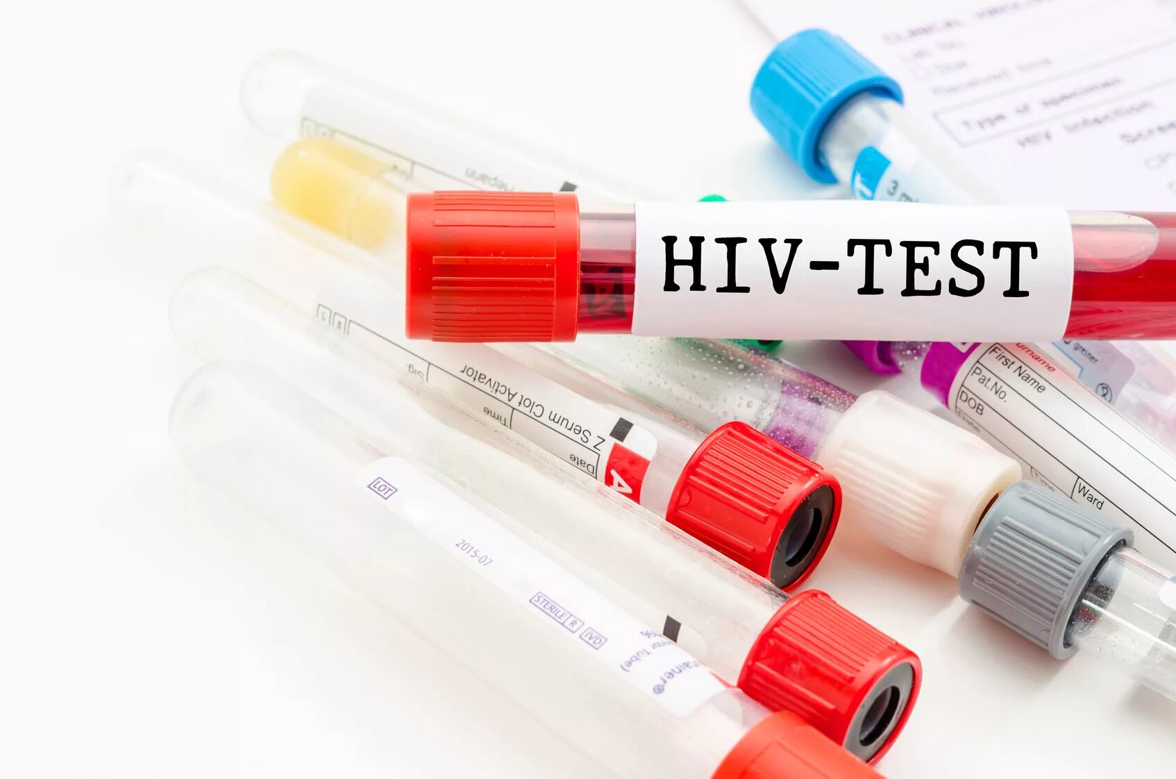 Тест на ВИЧ. Экспресс-тестирование на ВИЧ-инфекцию. ВИЧ тест пробирка.