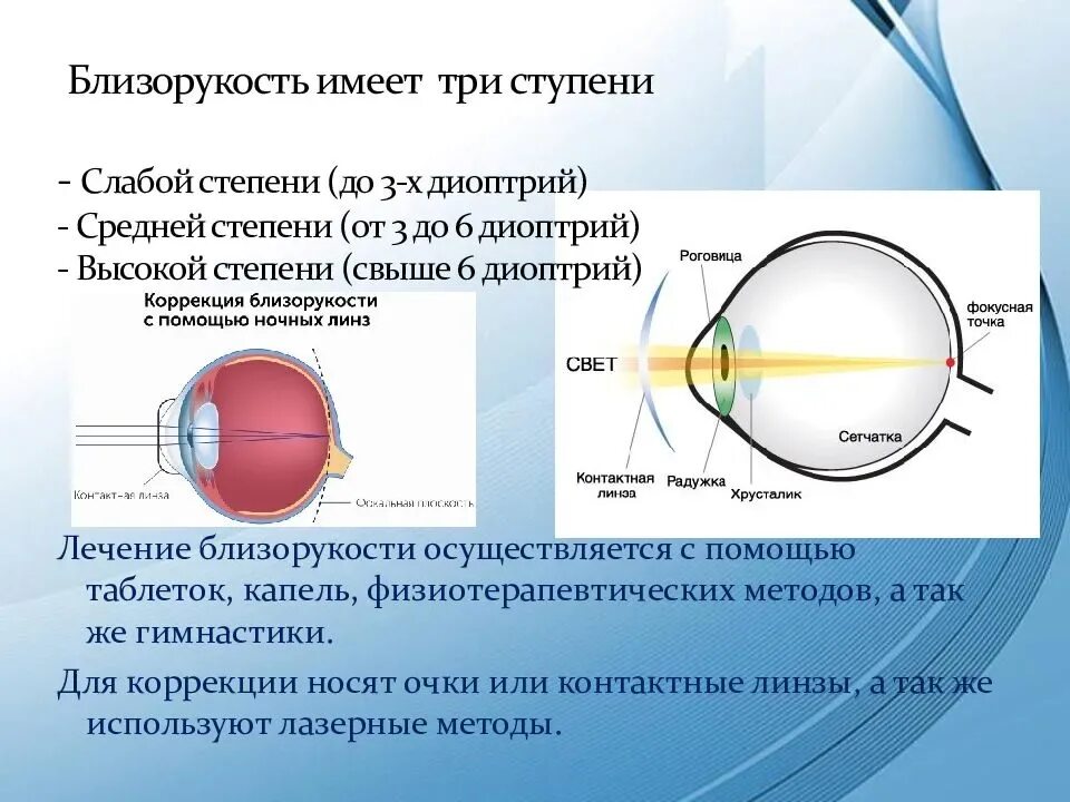 Дальнозоркость 3 степени. Миопия слабой степени. Близорукость слабой степени. Миопия слабой средней степени. Миша страдает близорукостью а его брат