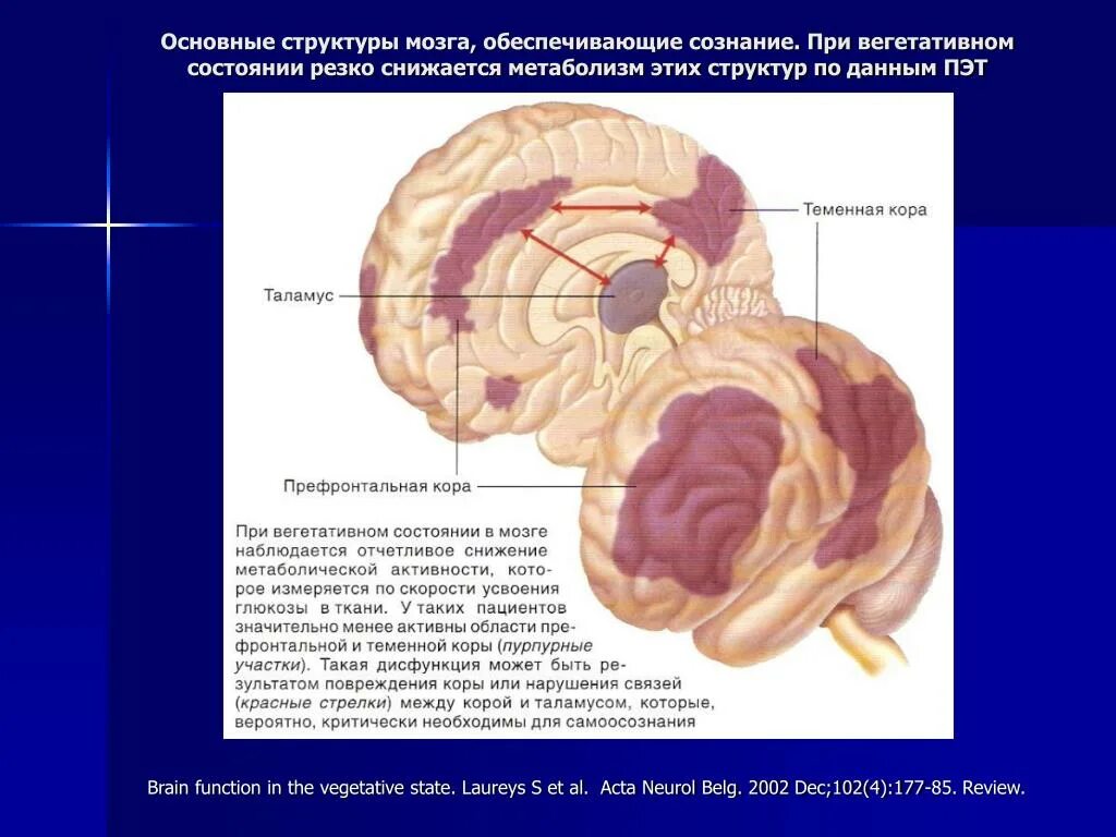 Дисфункция срединных структур мозга это. Сознание структуры мозга. вегетативная состояние мозга. вегетативное состояние головного мозга. структуры мозга ответственные за сознание.