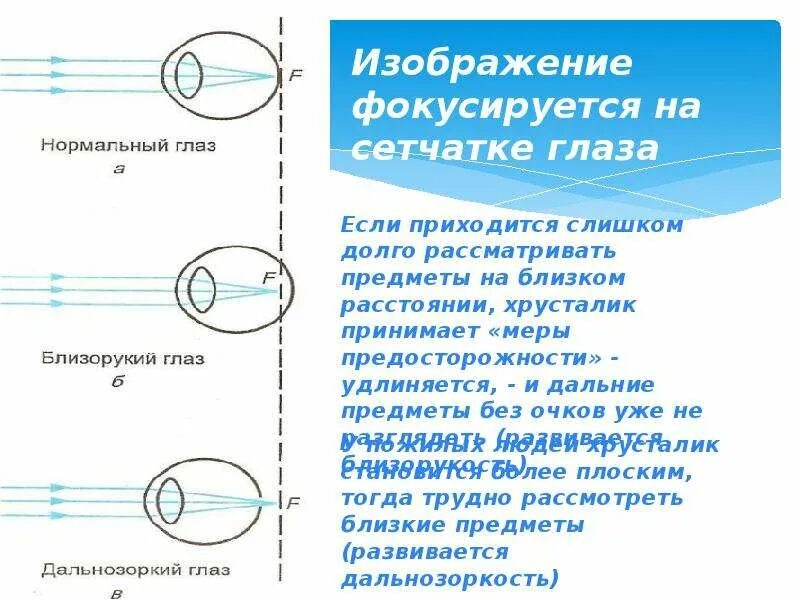 Какое изображение появляется на сетчатке глаза. Фокусировка изображения на сетчатке. Изображение фокусируется на сетчатке. Изображение фокусируется на сетчатке глаза. Изображение предмета на сетчатке глаза.