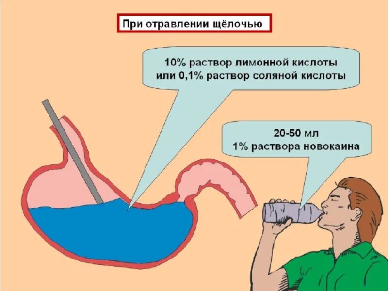 При попадании в глаза щелочного раствора необходимо