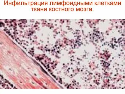 Фото лимфоидной ткани