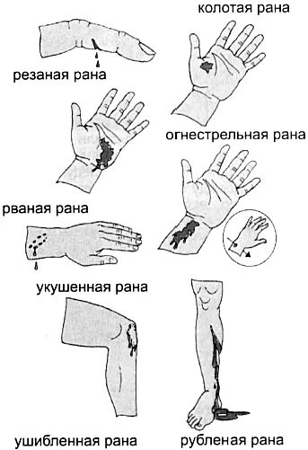 Какие рани есть