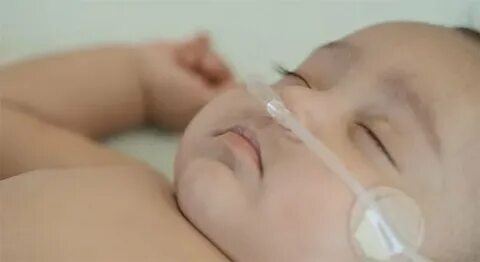 Бронхиты у новорожденных детей