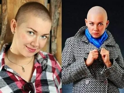 Сон побрили налысо