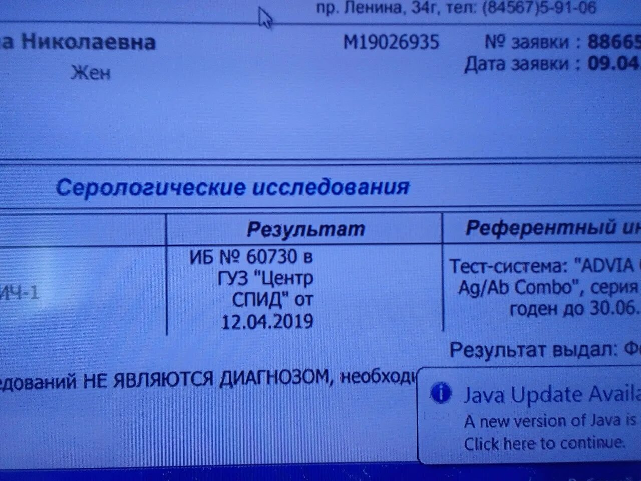 Анализы на вич можно кушать. Анализ на ВИЧ. Результат анализа на ВИЧ. Результат анализов на ВИС. Анализ на ВИЧ отрицательный.