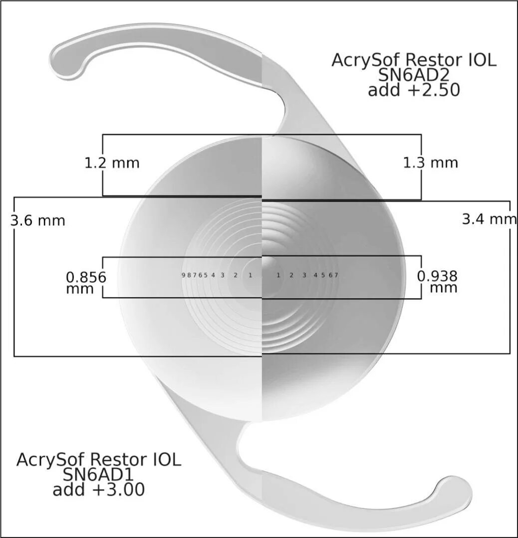 Американские алкон для глаза. ИОЛ 20 alkon. ИОЛ ACRYSOF sn60wf IQ. Линза ACRYSOF IQ. Мультифокальные линзы ИОЛ.