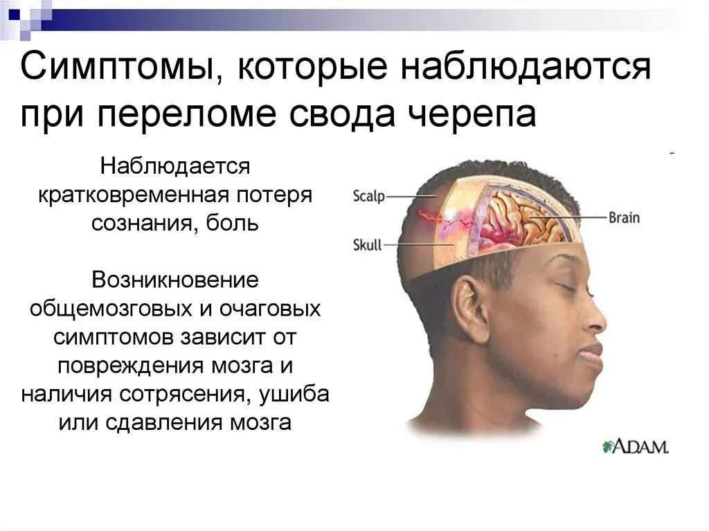Картинки ПЕРЕЛОМ СВОДА