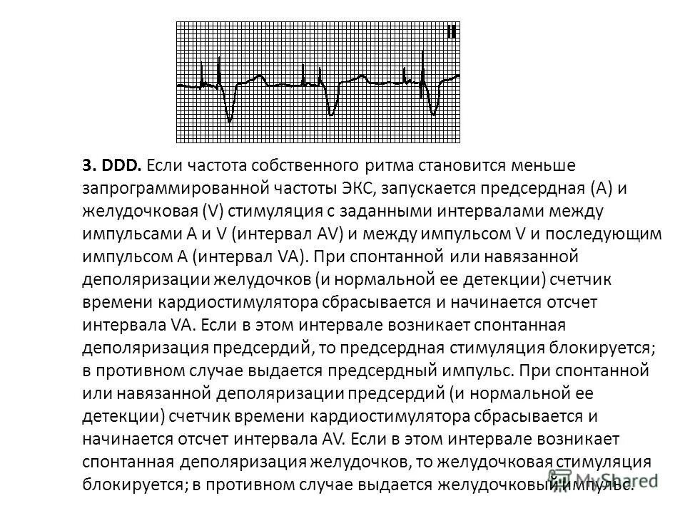 Как измерить частоту сердечных. Интервалы RR на ЭКГ И ЧСС. Интервал r r в ЭКГ. Интервалы RR на ЭКГ таблица. Интервал рр на ЭКГ.