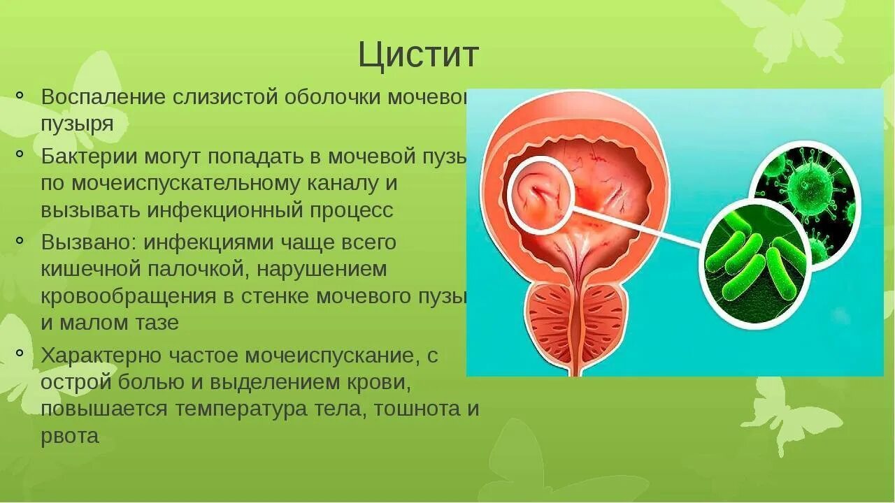 Цистит симптомы меры профилактики. Цистит мочевыделительной системы. Заболевания мочевыделительной системы цистит. Профилактика заболеваний мочевыделительной системы. Воспалительные заболевания органов мочевой системы.