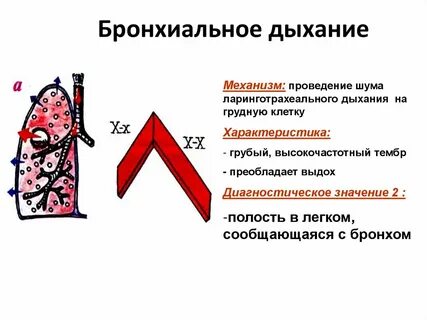Для хрипов характерно