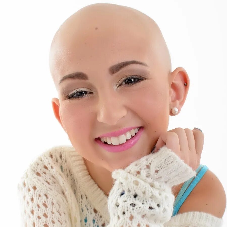 лысые женщины. энн хэтэуэй лысая. натали портман лысая. марина лисовая. лысые девушки подростки.