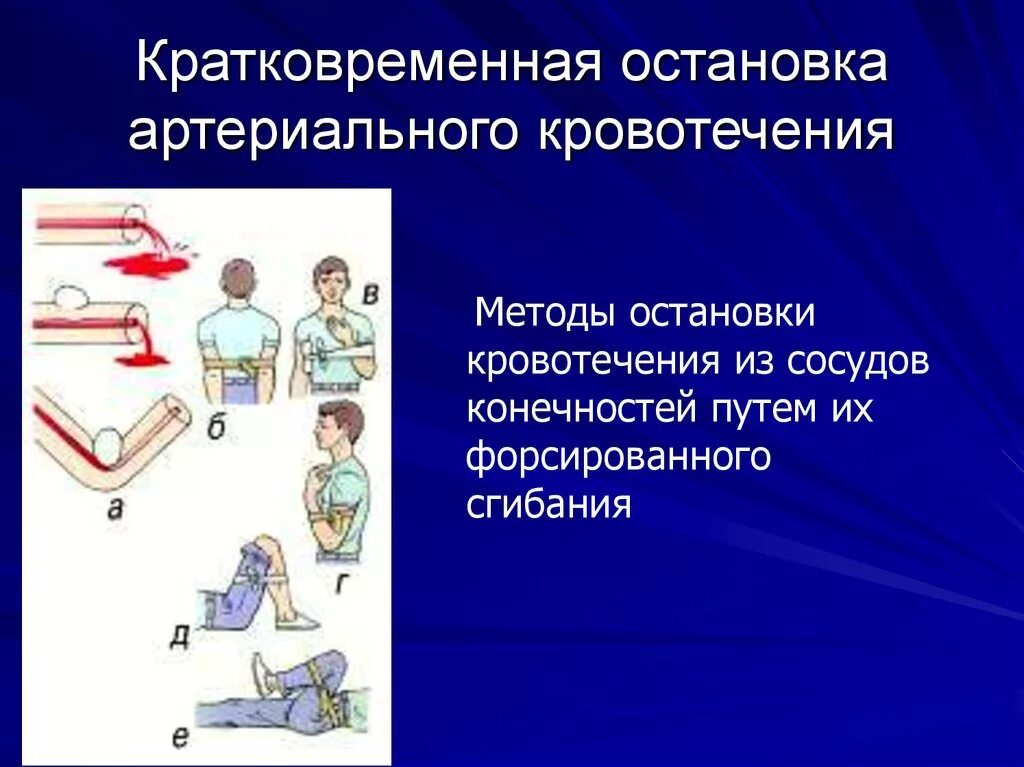 Способы остановки кровотечения лица. Остановка артериального кровотечения. Методы остановки кровотечения. Методы остановки кровотечения из сосудов конечностей. Метод остановки артериального кровотечения.