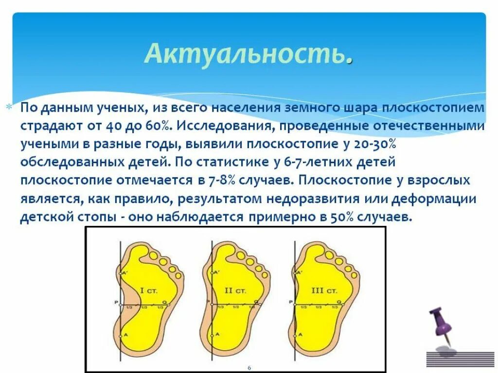 Выявление нарушения плоскостопия осанки лабораторная. Развитие плоскостопия. актуальность плоскостопия. понятие о плоскостопии. плоскостопия детей актуальность.