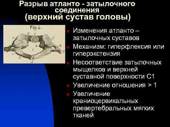 Кт анатомия атланто-окципитального сочленения. Атланто затылочный сустав. Разрыв атланто-окципитального сочленения. Атланто затылочный сустав строение.