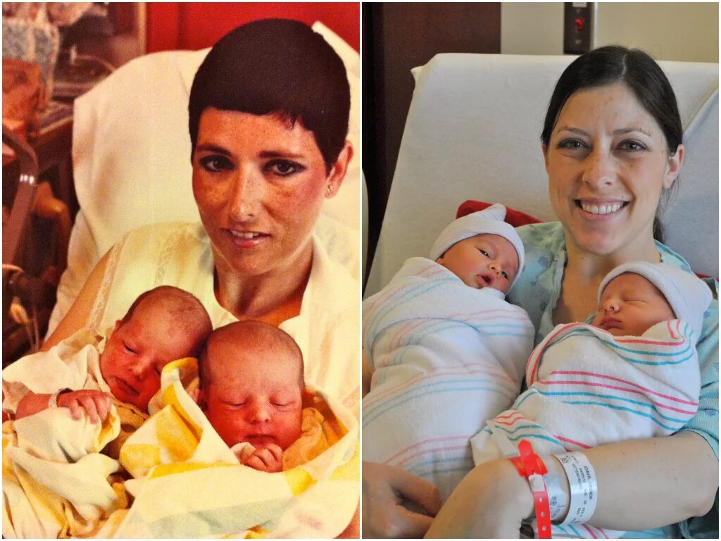 Эко двойня. Выносить двойню. Двойняшки и близнецы в эко. Выносить двойню. Разница близнецов от двойняшек.