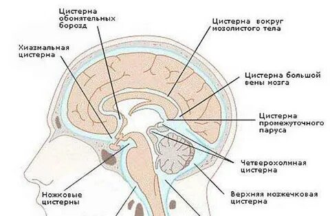 Признаки заместительного расширения ликворных пространств