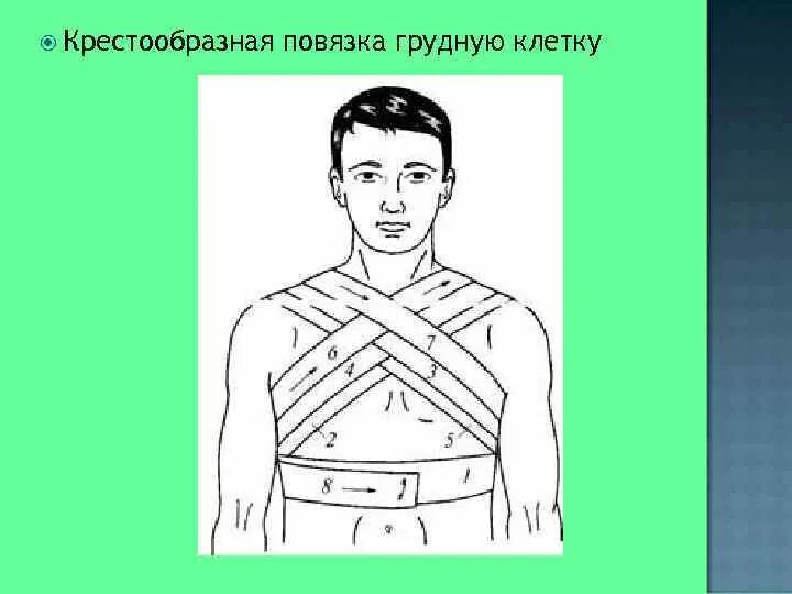 Техника наложения повязок на грудную клетку
