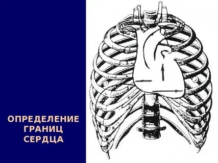 Границы сердца