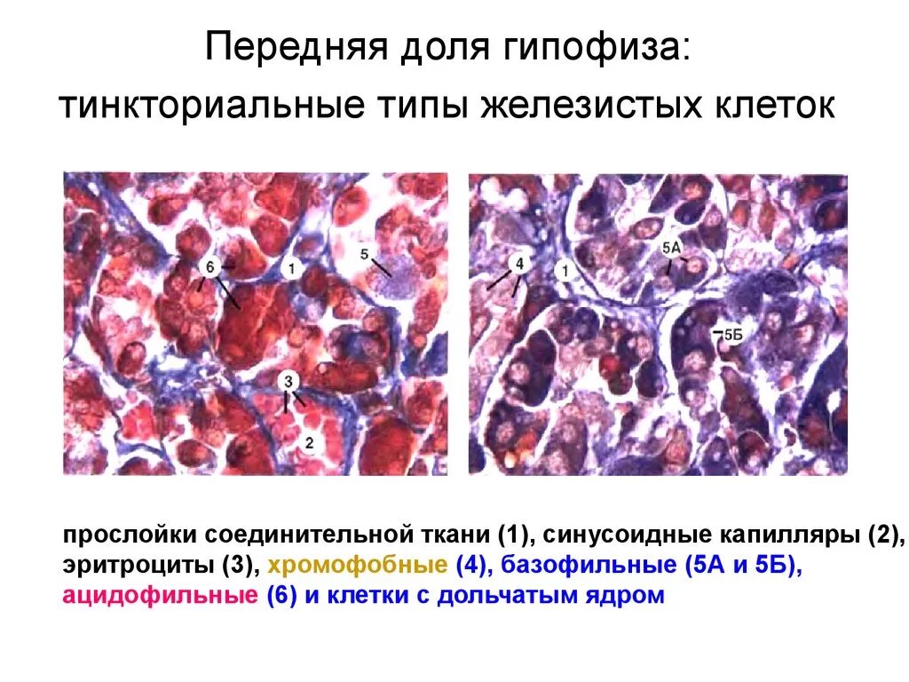 Базофильные клетки передней доли гипофиза и их гормоны. Хромофобные эндокриноциты гипофиза. Клетки гипофиза гистология. Ацидофильные клетки передней доли гипофиза:.
