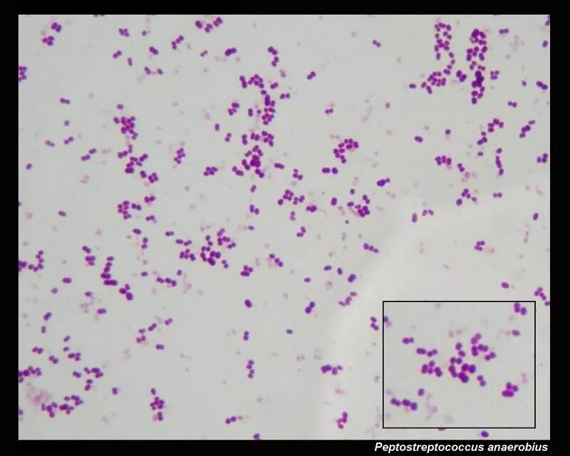 Peptostreptococcus. Стрептококки пептострептококки. Пептострептококки микроскопия. Стрептококк микроскопия. Морфология пептострептококков.