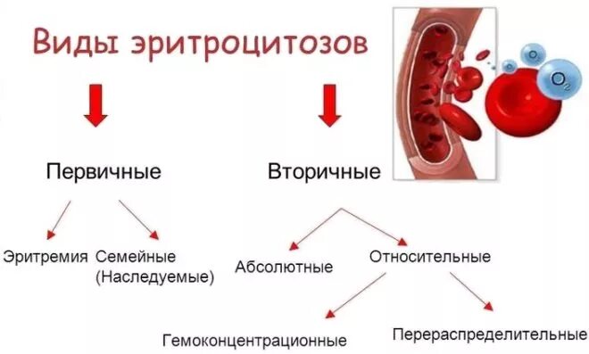 Эритроцитоз причины. Виды относительных эритроцитозов. первичный эритроцитоз картина крови. относительный эритроцитоз. эритроцитоз классификация.