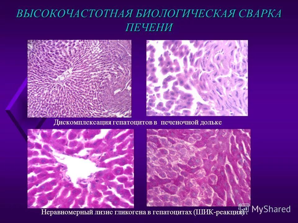 Зрелые клетки не способны к делению. Тонкоигольная биопсия печени. Какие ткани не способны к делению. Гистологический анализ печени. Строение паренхимы печени гистология.