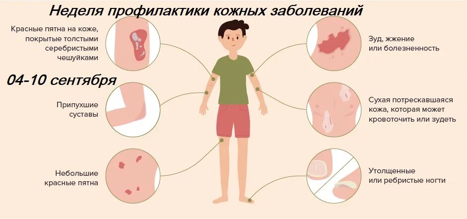 Названия кожных заболеваниях у взрослых