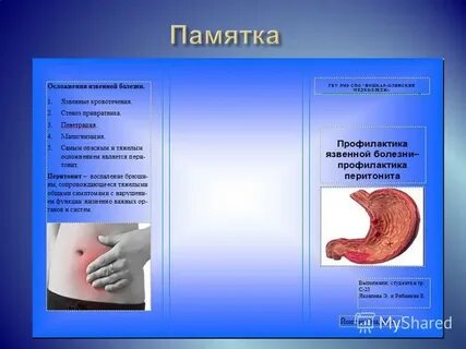 Профилактика язвенной болезни