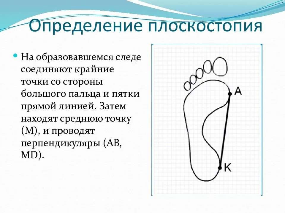 Чем может быть вызвано плоскостопие у человека. Методы выявления плоскостопия. Методика выявления плоскостопия у детей по отпечатку стопы. Формула выявления плоскостопия. Исследование свода стопы для выявления плоскостопия.