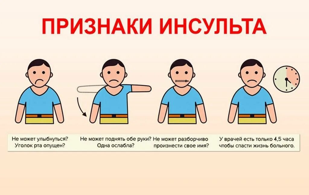 Первые признаки прединсульта у женщины. Основные критерии инсульта. инсульт симптомы. признаки инсульта. первые признаки инсульта.