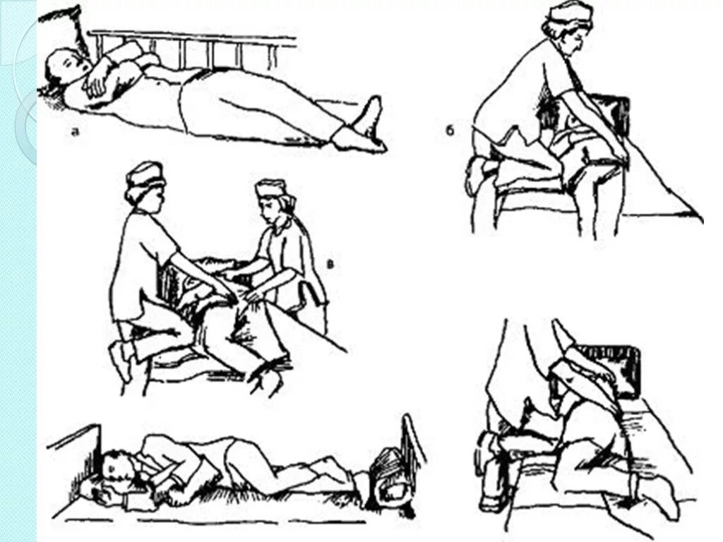 Смена тяжелобольных. Перемещение пациента в постели. Перемещение тяжелобольного пациента в постели. Перемещение тяжелобольного пациента к краю кровати. Техника перемещения тяжелобольного в постели.