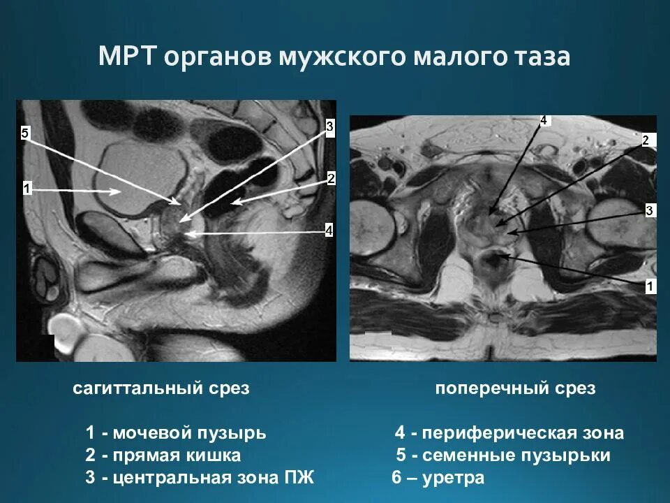 Отличия мужского и женского таза. Малый таз у мужчин что это такое. Малый таз у мужчин что это такое. Малый таз у мужчин что это такое. Малый таз у мужчин что это такое.