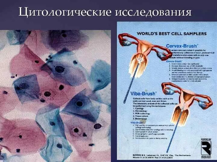 Количество цитологических исследований. Цитологическое исследование. методы цитологических исследований. цитологический метод исследования опухоль. виды цитологического исследования.