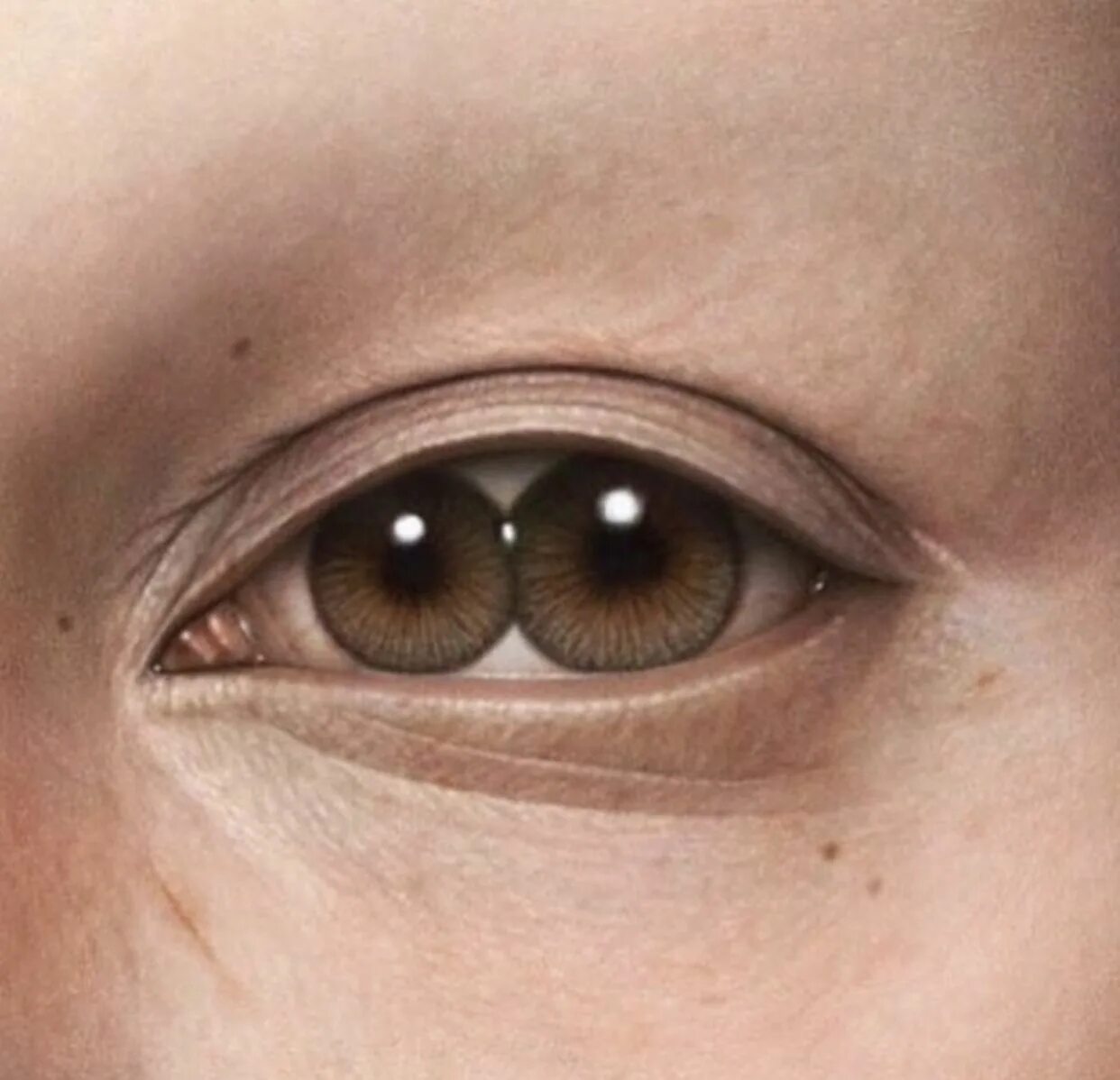 Second eye. PUPULA Duplex двойной зрачок.