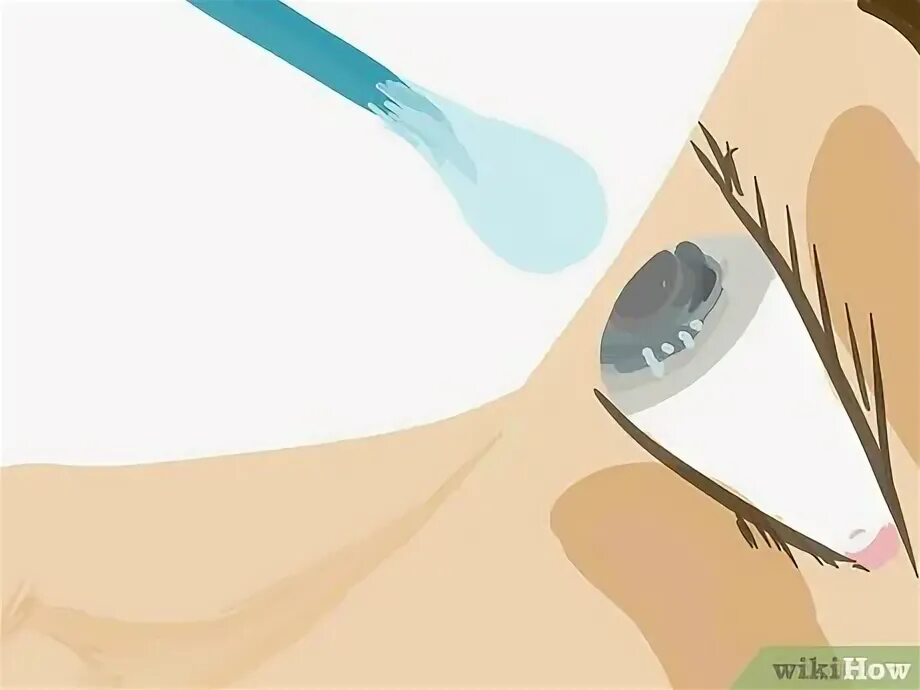 А то в глаз попадет. Причины развития синдрома сухого глаза. Признаки синдрома сухого глаза. Перекись водорода попала в глаз. А то в глаз попадет.