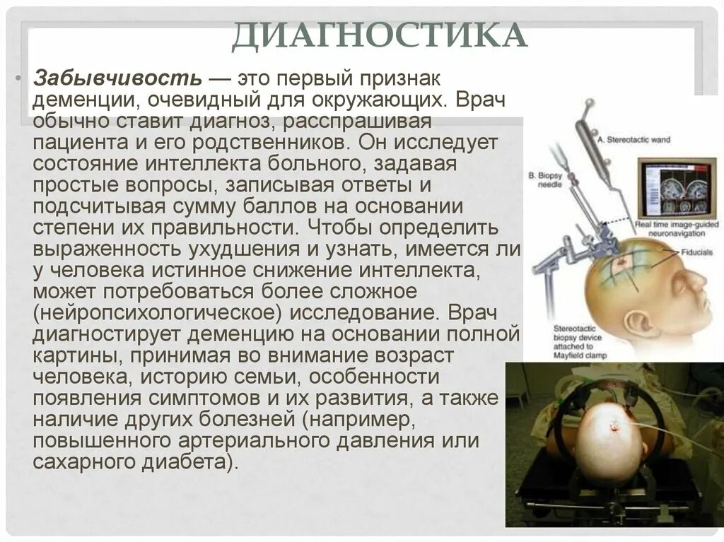 Как диагностируется деменция. Диагноз деменция. Признаки деменции диагностика. Кто ставит диагноз деменция. Как диагностировать деменцию