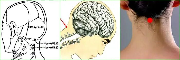 Видео почему голова. Точки от головной боли в затылке. Точки на затылке головы. Точки от затылочной головной боли. Точечный массаж головы от головной боли.