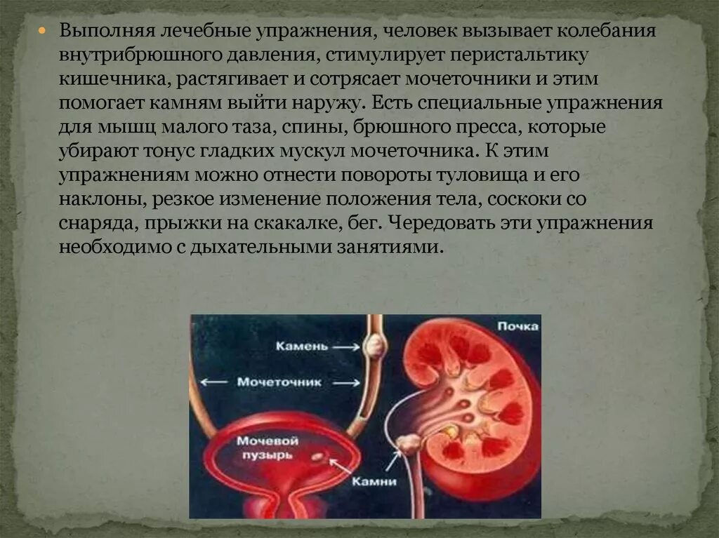 Сильные боли в мочеточнике. Упражнения для вывода камней из мочеточника. Гимнастика для выведения камней из почек. Упражнения для выведения камня из мочеточника. Гимнастика для выведения камней из мочеточника.