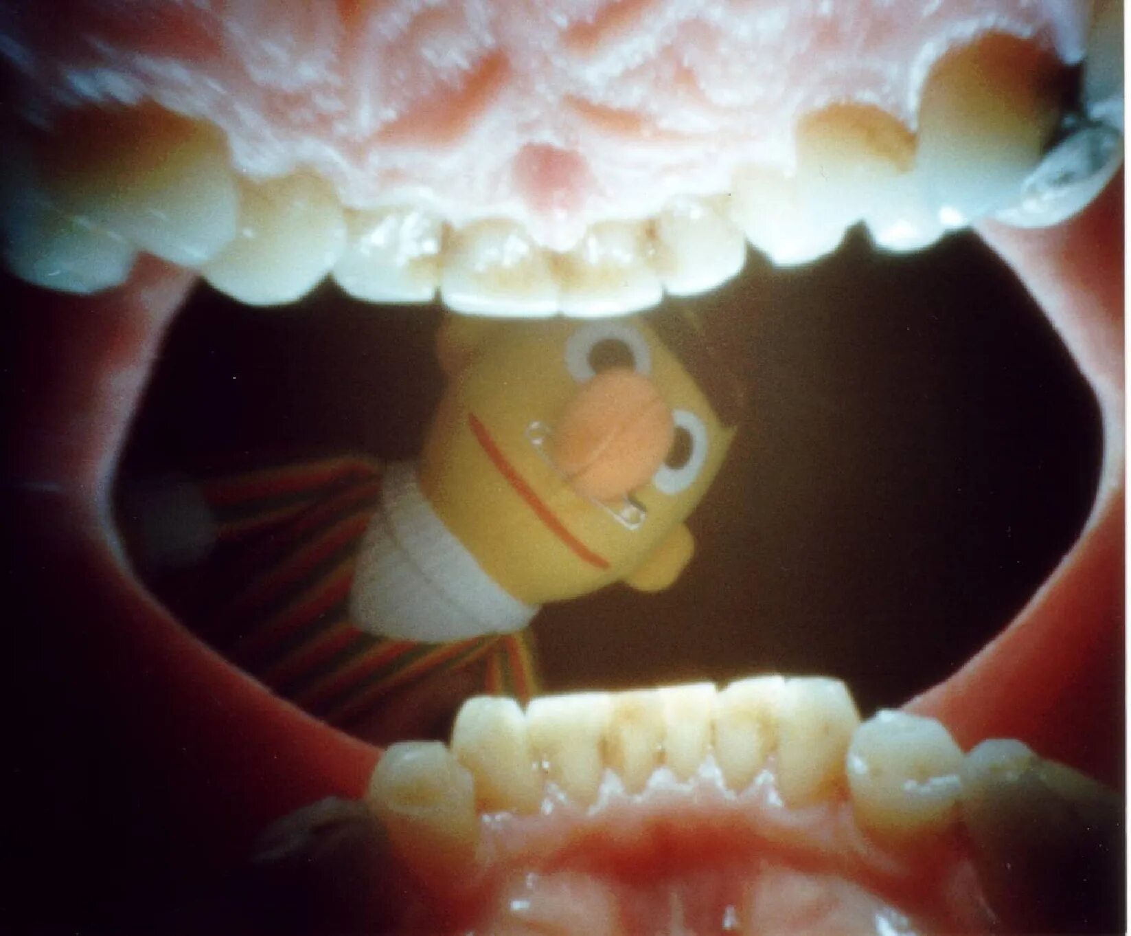 Зубы внутри рта. Ротовая полость изнутри.