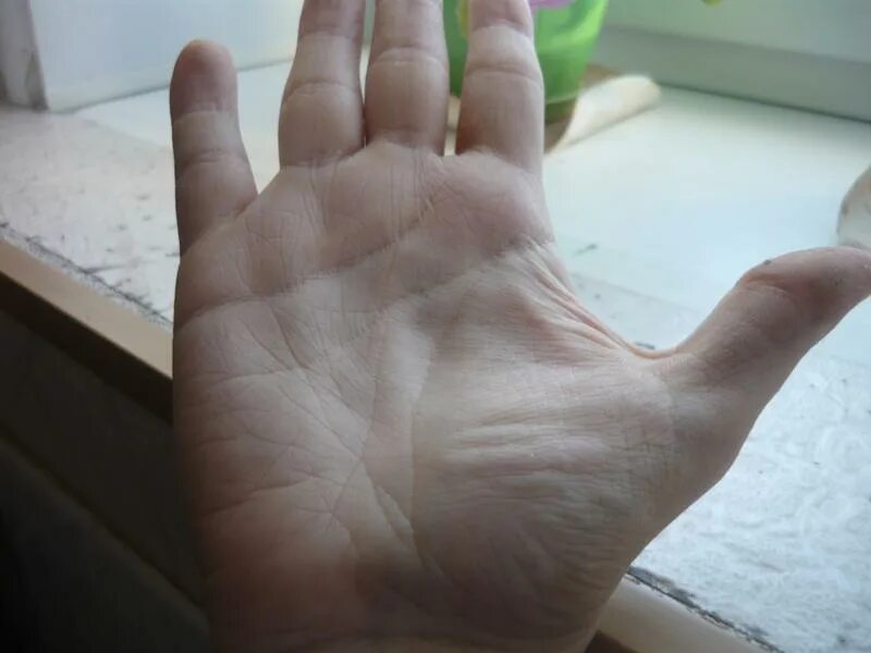 Знаки на холме юпитера. Холм юпитера хиромантия. Квадрат на холме юпитера. Квадрат учителя на ладони. Знаки на бугре юпитера.