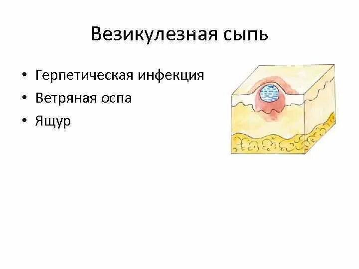 Бесцветная кожа