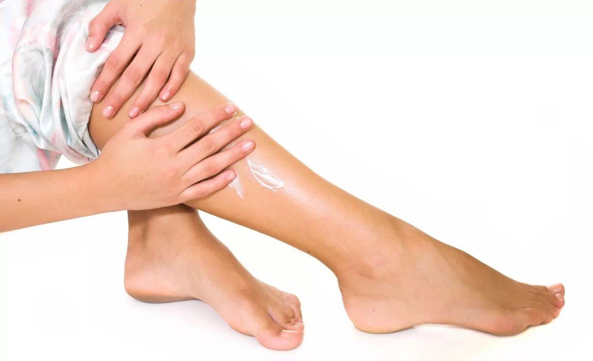 Лечение варикоза на ногах. Нанесение крема на ноги. Варикозное расширение вен.