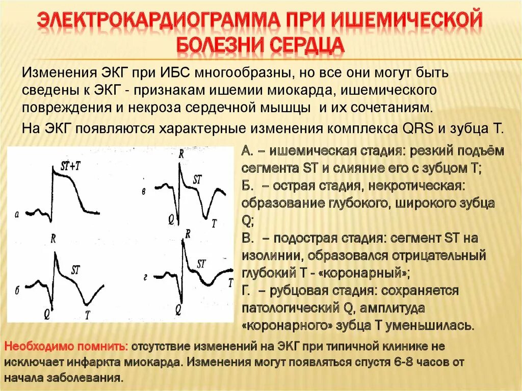 Болезни на экг